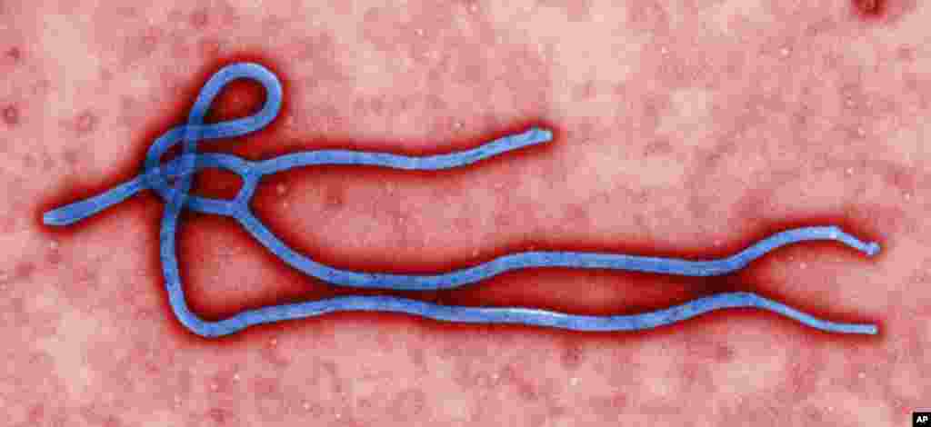 This photo provided by the CDC shows an Ebola virus. U.S. health officials are monitoring the Ebola outbreak in Africa, but say the risk of the deadly germ spreading to the United States is remote