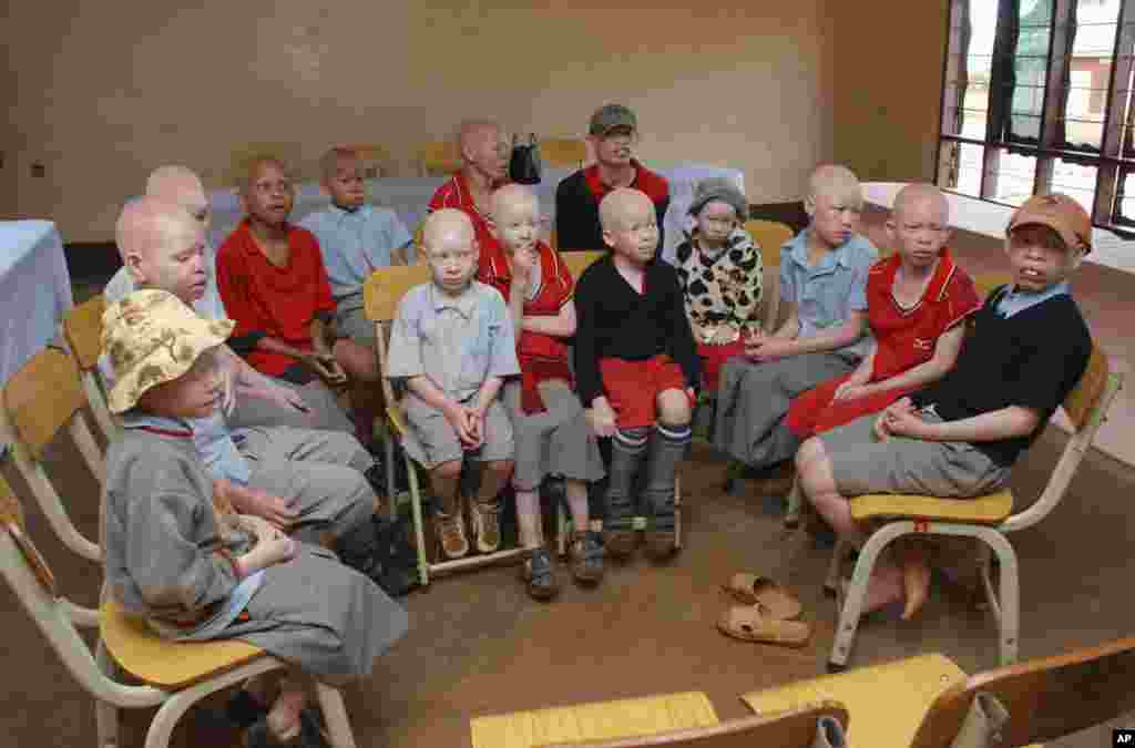 Children with albinism sit at the Golden Valley English Medium School, a school sponsored by Under the Same Sun (UTSS), in Geita November 24, 2011. UTSS is a Canadian non-profit organization that sponsors more than 300 pupils with albinism from Tanzania.