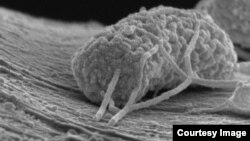 A microbe is seen under a microsope. (Xing Xie, Stanford Engineering)