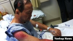 지난 9일 미국 앨라배마주 몽고메리에서 흑인 일가족 강도단에게 휴대전화를 빼앗기고 용의자 차를 쫒아가다 중상을 입은 탈북자 안드레 조씨가 병원에서 치료를 받고 있다.