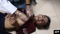 An injured Palestinian boy receives medical attention at Al-Aqsa Martyrs Hospital after an Israeli strike hit a school housing displaced people in Deir al-Balah in the central Gaza Strip on Oct. 10, 2024.