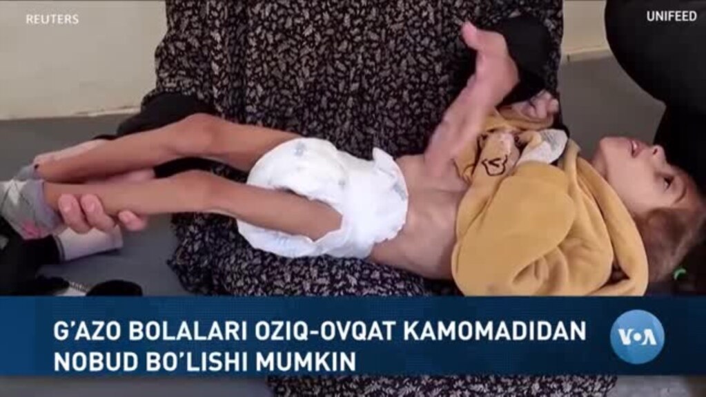 Xalqaro hayot - 3-yanvar, 2025-yil - G’azo bolalari oziq-ovqat kamomadidan nobud bo’lishi mumkin