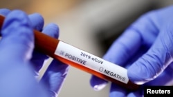  FILE PHOTO: Test tube with Corona virus name label is seen in this illustration taken on January 29, 2020. REUTERS/Dado Ruvic/File Photo