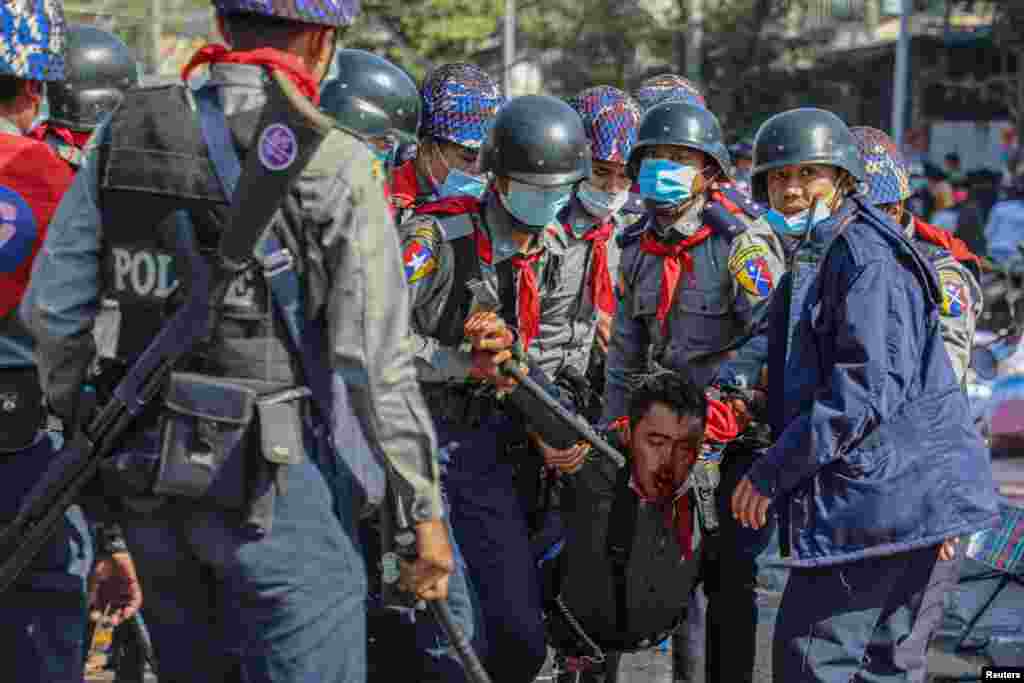 Police carry their injured fellow member as people protest against the military coup, in Mandalay, Myanmar, Feb. 9, 2021.