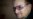 Bono dice que sufre de glaucoma