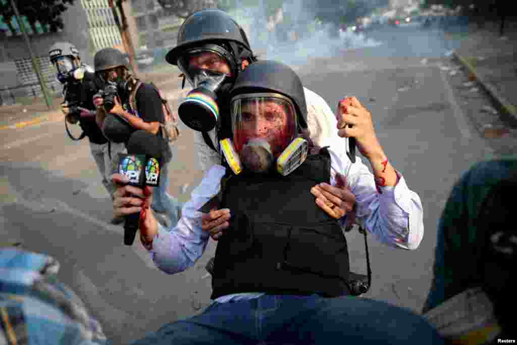An injured member of the media is carried away during a rally against the government of Venezuela's President Nicolas Maduro and to commemorate May Day in Caracas, May 1, 2019.