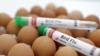 Tabung-tabung uji yang berlabel "Flu Burung" dan telur terlihat dalam sebuah ilustrasi, 14 Januari 2023. (Foto: REUTERS/Dado Ruvic)