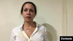 Imágenes de la opositora venezolana, tras agresión denunciada por Vente Venezuela, movimiento político venezolano, y su equipo.