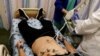Seorang pasien yang menderita long COVID menjalani pemeriksaan di klinik khusus bagi para pasien yang telah terjangkit COVID-19 di Rumah Sakit Ichilov di Tel Aviv, Israel, pada 21 Februari 2022. (Foto: Reuters/Amir Cohen)