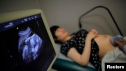 FILE - A pregnant woman gets a sonogram at a hospital in Shanghai, Sept. 12, 2014.