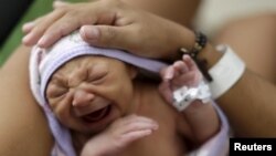 Sueli Maria (obscured) holds her daughter Milena, who has microcephaly, (born seven days ago), at a hospital in Recife, Brazil, Jan. 28, 2016.