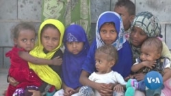 Yemeni Children Victimized by 'World's Worst Humanitarian Crisis'