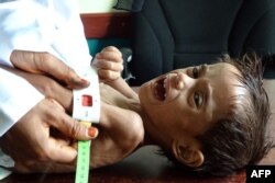 Ahmed Abdo Salem, a 2-year-old Yemeni child displaced by conflict and suffering from malnutrition (weighing only five kilos), is measured at a health clinic in the war-ravaged western Hodeida province,  Yemen, Feb. 15, 2021.