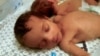 Majke bebe iz bolnice Al Šifa: Nismo znali da li nam je sin živ ili mrtav
