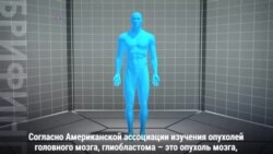 Глиобластома: что кроется под страшным диагнозом?