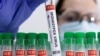Illustration montrant des tubes à essai étiquetés "virus de la variole du singe positif".