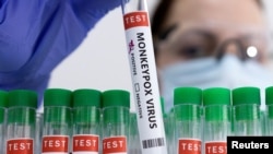 FILE: Test tubes labeled "Monkeypox virus positive" shown in a laboratory, May 23, 2022