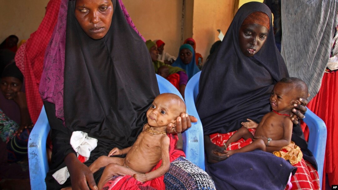 Malnourished babies are held by their mothers, both of whom fled the drought in southern Somalia, at a feeding center in a camp in Mogadishu, Somalia, Feb. 25, 2017.