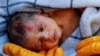Gempa Turki: Bayi Berhasil Diselamatkan dari Reruntuhan, Korban Jiwa Capai 23.700