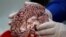 A doctor holds a human brain in a brain bank in the Bronx borough of New York City, New York, U.S. June 28, 2017. REUTERS/Carlo Allegri