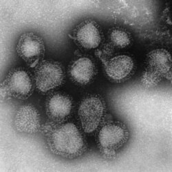 ویروس آنفلوانزای اچ۳ ان۲ زیر میکروسکوپ