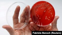 Seorang petugas laboratorium di Berlin, Jerman menunjukkan "superbug" atau bakteri kebal obat (foto: ilustrasi). 