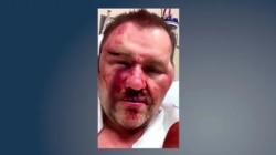 Photo provided by former Achille Mayor David Northcutt after attack at a convenience store in March 2019.