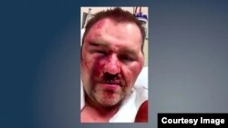 Photo provided by Achille Mayor David Northcutt after attack at a convenience store in March 2019. 