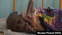 En images : la malnutrition à Diffa 