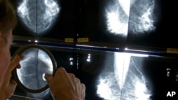 FILE - Radiologist uses magnifying glass to check mammograms for breast cancer in Los Angeles.