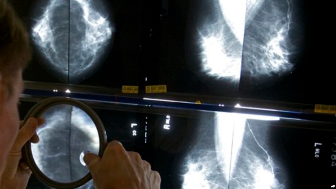 Radiolog proverava mamogram koristeći lupu