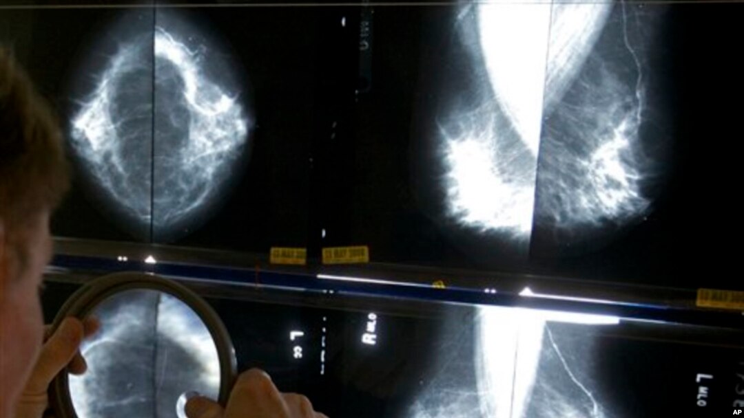 FILE - A radiologist uses a magnifying glass to check mammograms for breast cancer.
