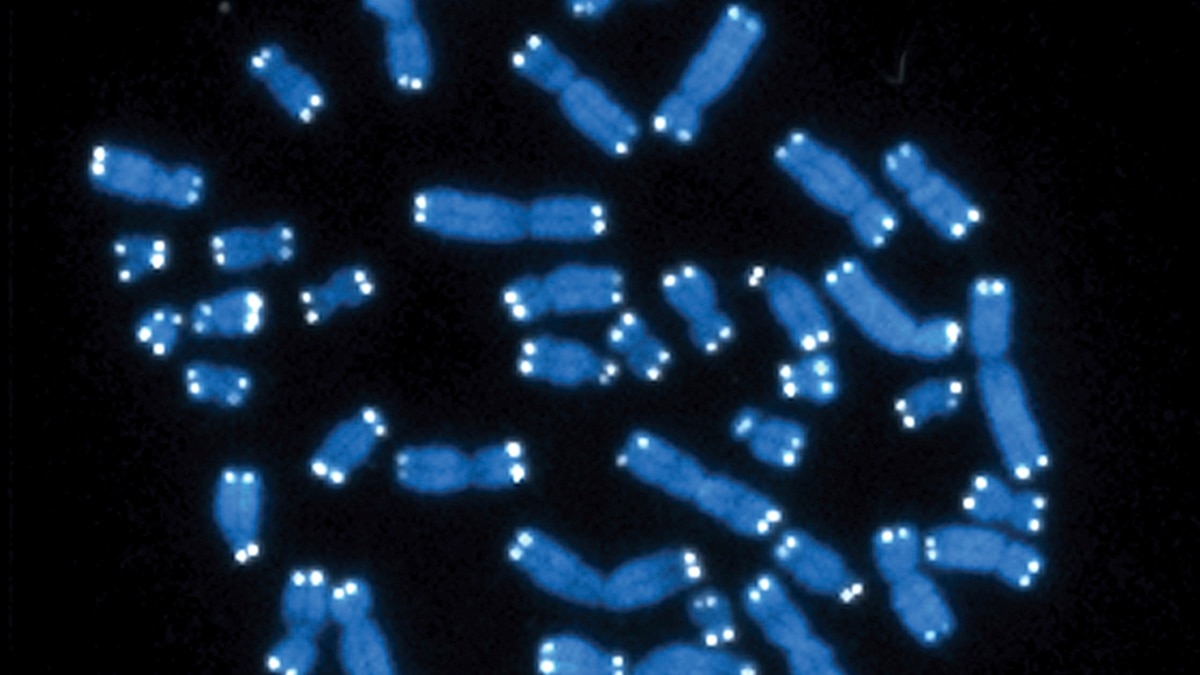 Researchers Find Gene behind Disorder Causing Intellectual Disability - Vimarsana News