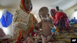 Zara Mahamat, suffering from malnutrition, receives treatment in an intensive care tent at the hospital in N'Gouri, a desert village in Chad, April 18, 2012.
