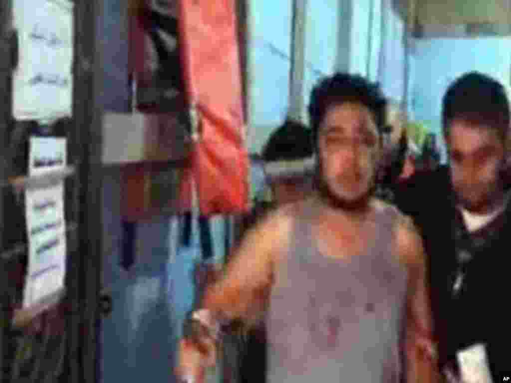 This image released February 6, 2012, purports to show a wounded man outside a hospital in Homs, Syria. (AP/Shaam)