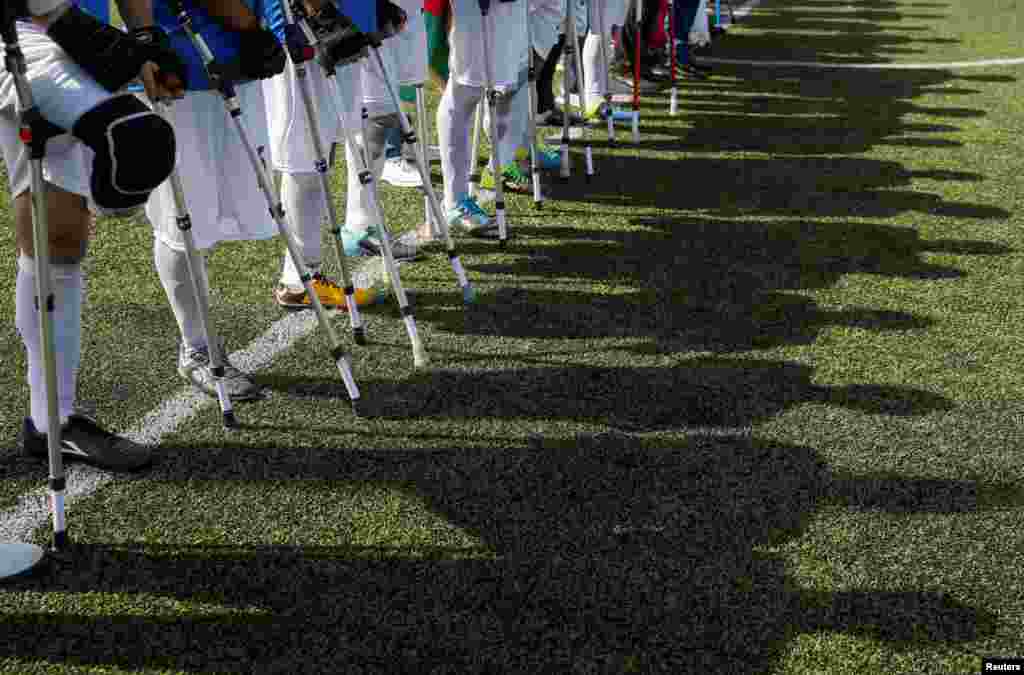 Amputee soccer players line up before a friendly match between Ukrainian and Azeri teams in Kyiv, Ukraine.
