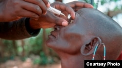 FILE - Dr. Amir Bedri examines a trachoma patient in Ethiopia.