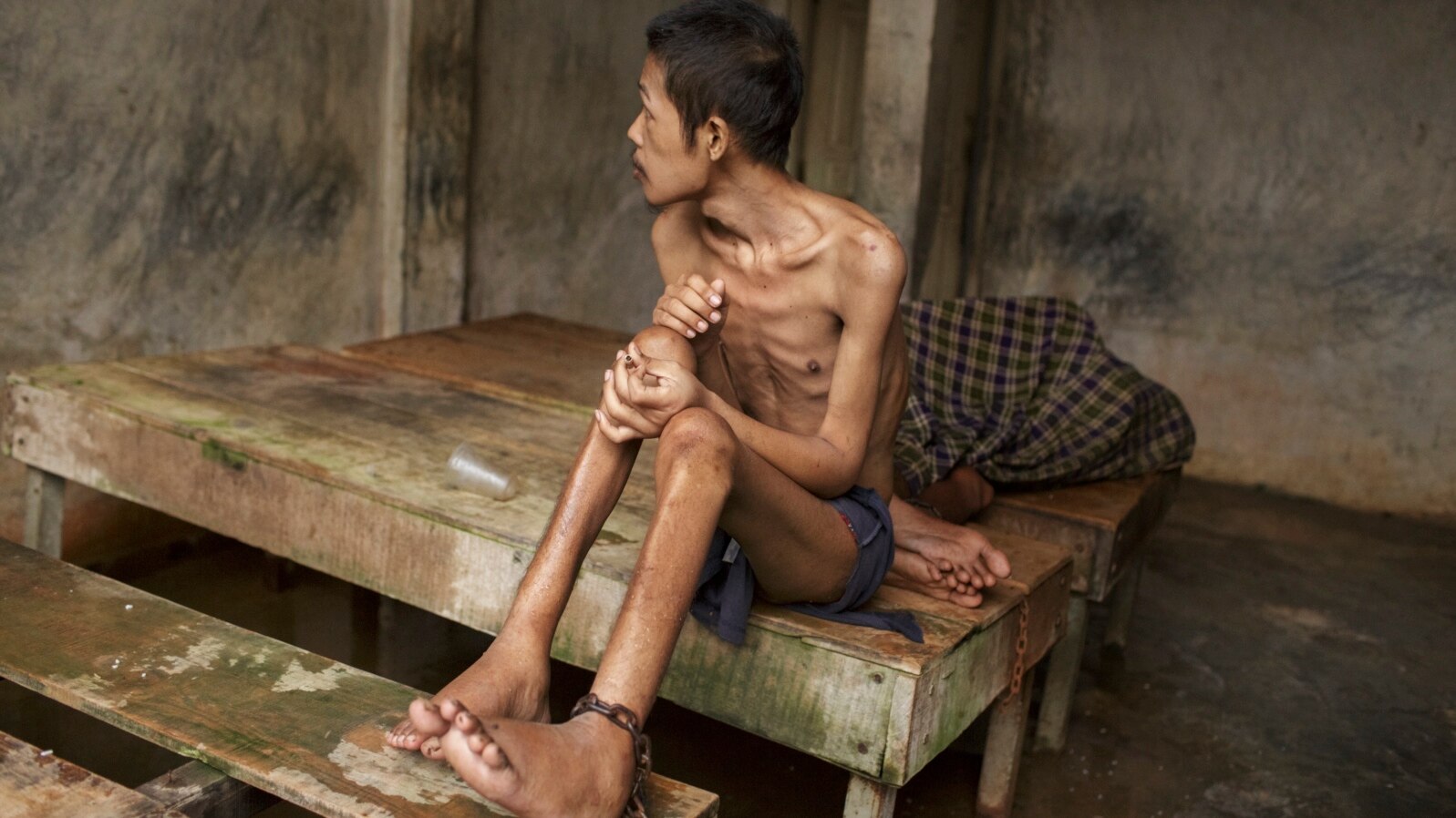 Before he died, this man lived chained to a platform at Kyai Syamsul's center in Brebes, Central Java. While there his ankles swelled, his body became emaciated. © 2012 Andrea Star Reese for Human Rights Watch