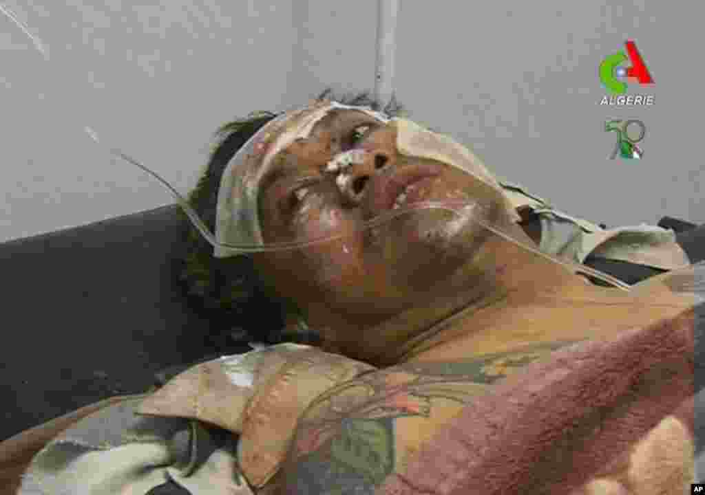 An unidentified rescued hostage receives treatment in a hospital Ain Amenas, Algeria, in this image taken from television Friday Jan. 18, 2013.