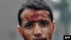 Участник акции протеста, получивший ранение на площади Тахрир