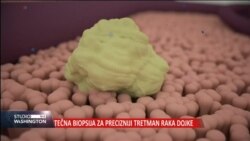 Testovi koji bi mogli pokazati rano prisustvo raka ili onog koji se vratio