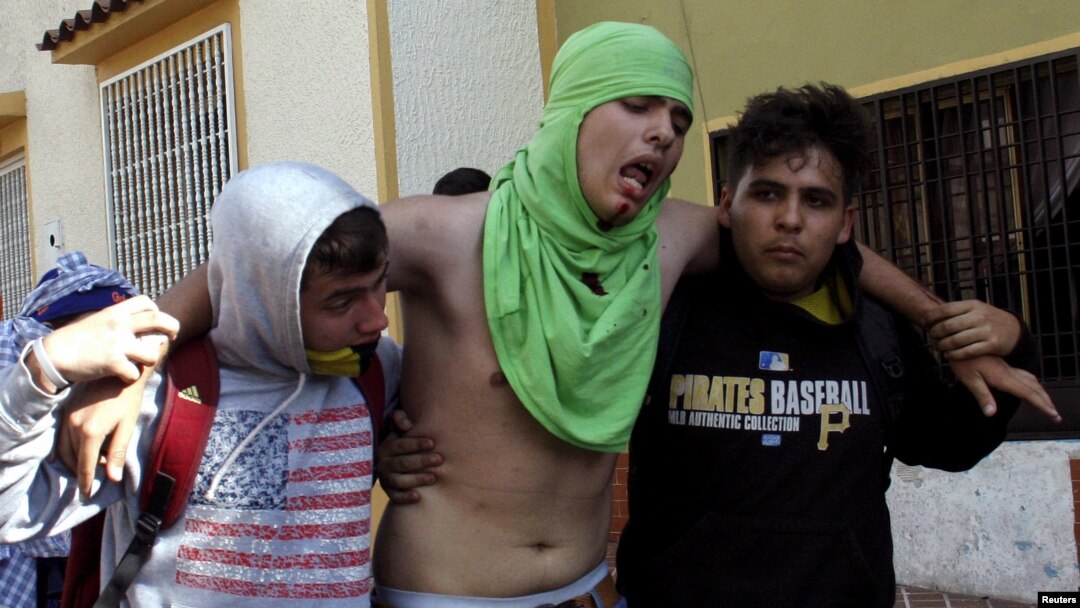 Un joven herido es ayudado por sus compañeros luego de enfrentarse con la policía en San Cristóbal, Venezuela, durante una protesta antigubernamental.