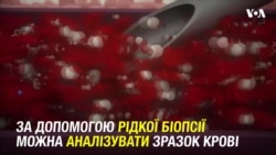 Аналіз крові здатний ідентифікувати тих жінок, які є більш схильними до рецидиву раку молочної залози. Відео