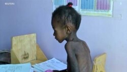 Yemeni Children Dying from Malnutrition as Warring Factions Block Aid