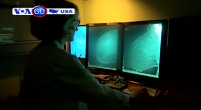 Phát hiện ung thư vú sớm không cần hóa trị