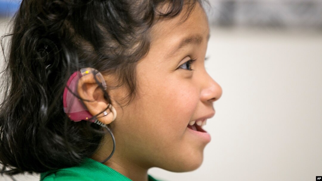 FILE - Angelica Lopez, 3, smiles during deafness therapy session at the University of Southern California, Los Angeles, Feb. 11, 2015.