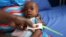 FILE - A muac tape used to screen malnutrition in children at the stabilization ward in Molai General Hospital Maiduguri, Nigeria Nov. 30, 2016. 