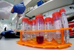 A lab assistant works on samples with Christian Drosten, director of the institute for virology of Berlin's Charite hospital on his researches on the coronavirus in Berlin, Jan. 21, 2020.