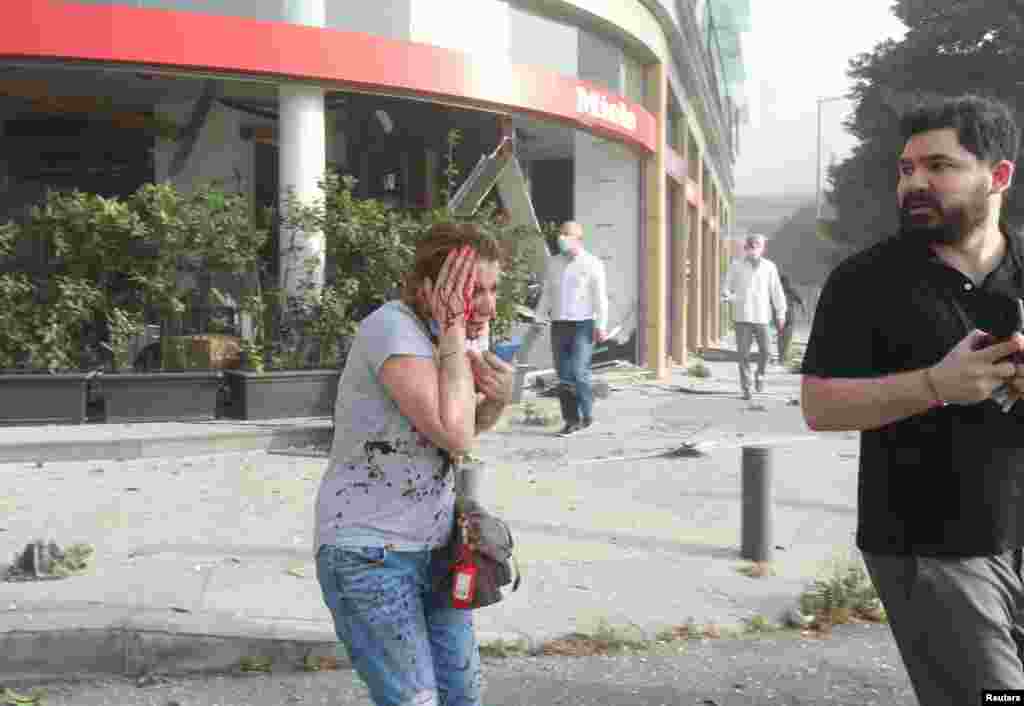 An injured woman is seen following an explosion in Beirut, Lebanon, Aug. 4, 2020. 