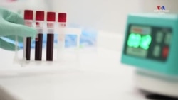 Քովիդ 19 հիվանդության ծագման մասին ԱՄՆ-ի հետախուզության նոր զեկույցը չի տալիս հստակ պատասխաններ